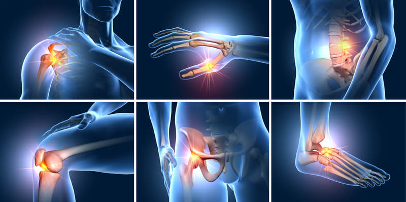 DOLOR ARTICULAR